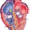 Electrical System of Heart Treatment In India Electrical System of Heart Treatment In India