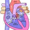 Heart Valve Replacement Surgery In India, Valve Surgeries Cost In India Heart Valve Replacement Surgery In India, Valve Surgeries Cost In India